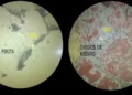 Microfotografías de oro bajo el microscopio calcográfico. En la sección de la izquierda se observa el oro dentro de la pirita y en la sección de la derecha se lo observa asociados a óxidos de hierro.